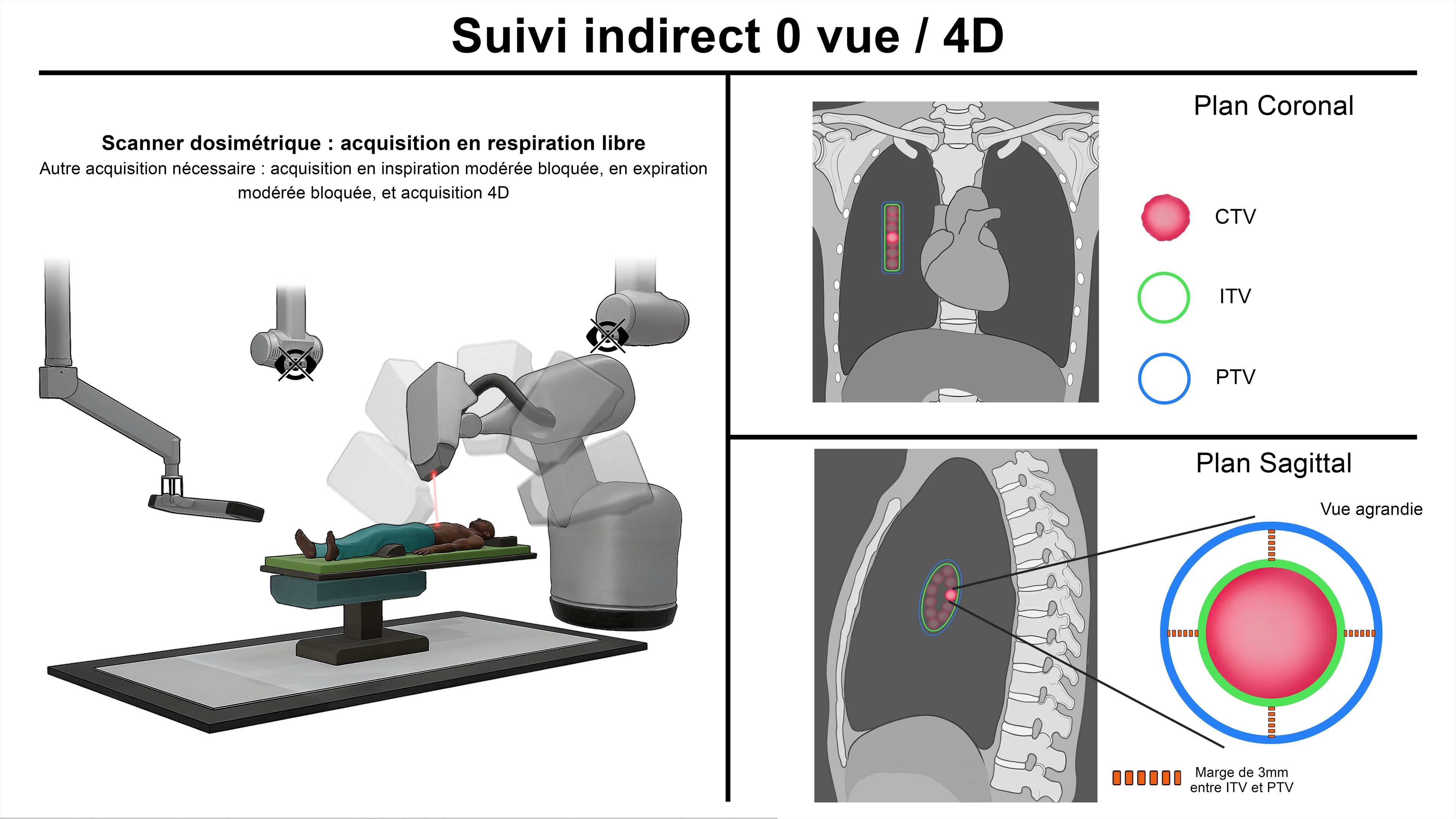 Thèse Comparatif Cyberknife par LucasG