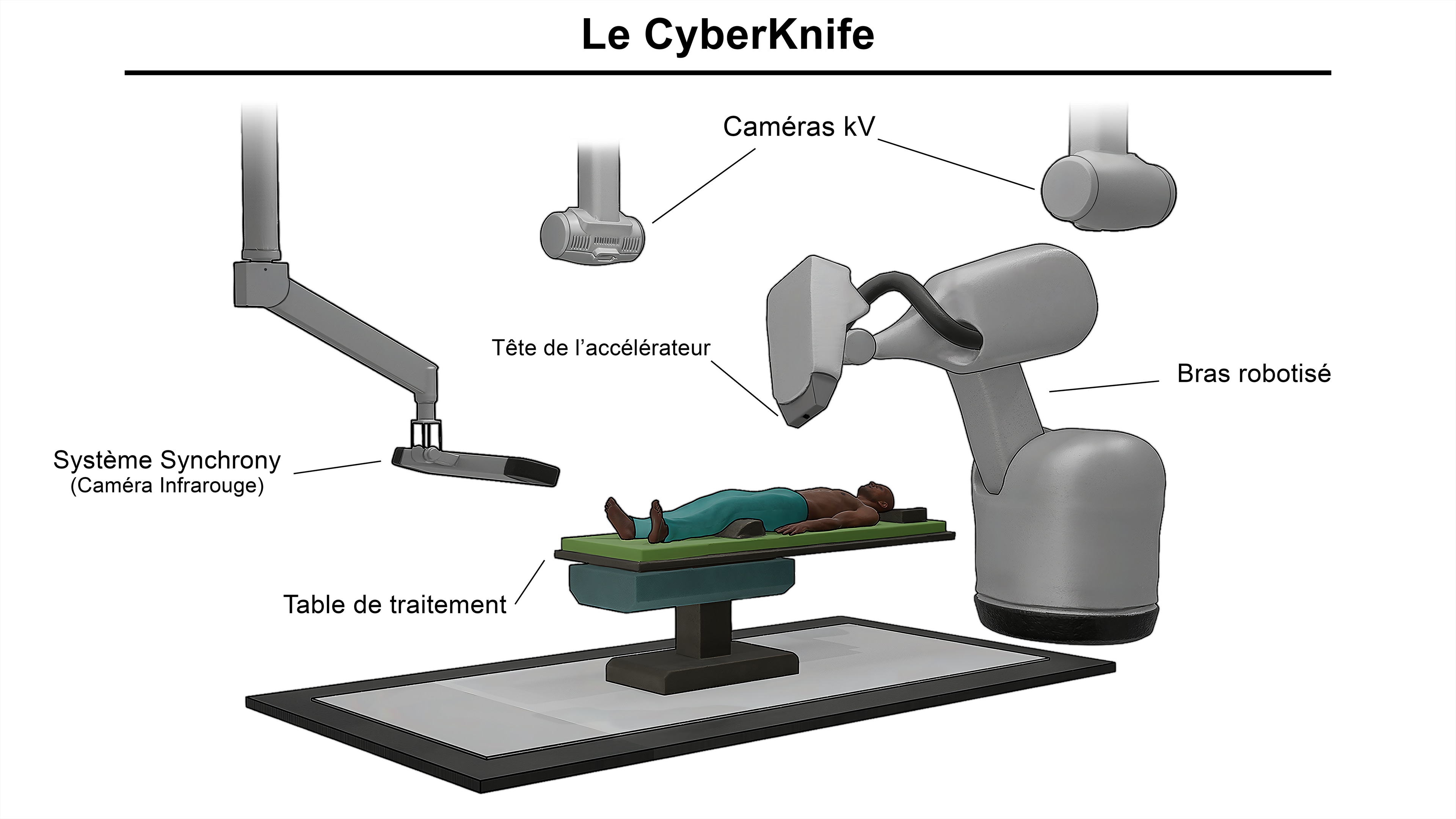Thèse Comparatif Cyberknife par LucasG