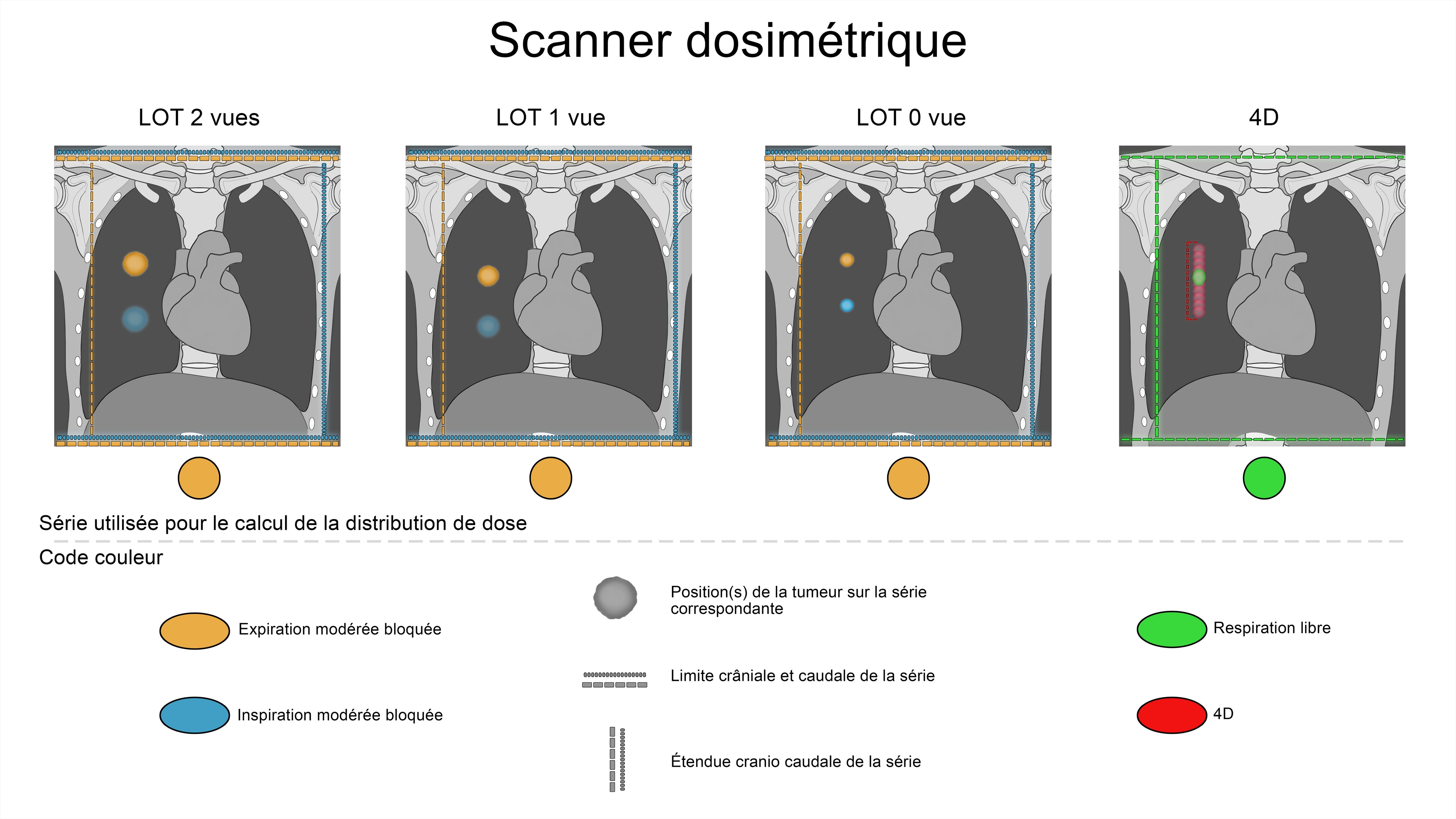 Thèse Comparatif Cyberknife par LucasG