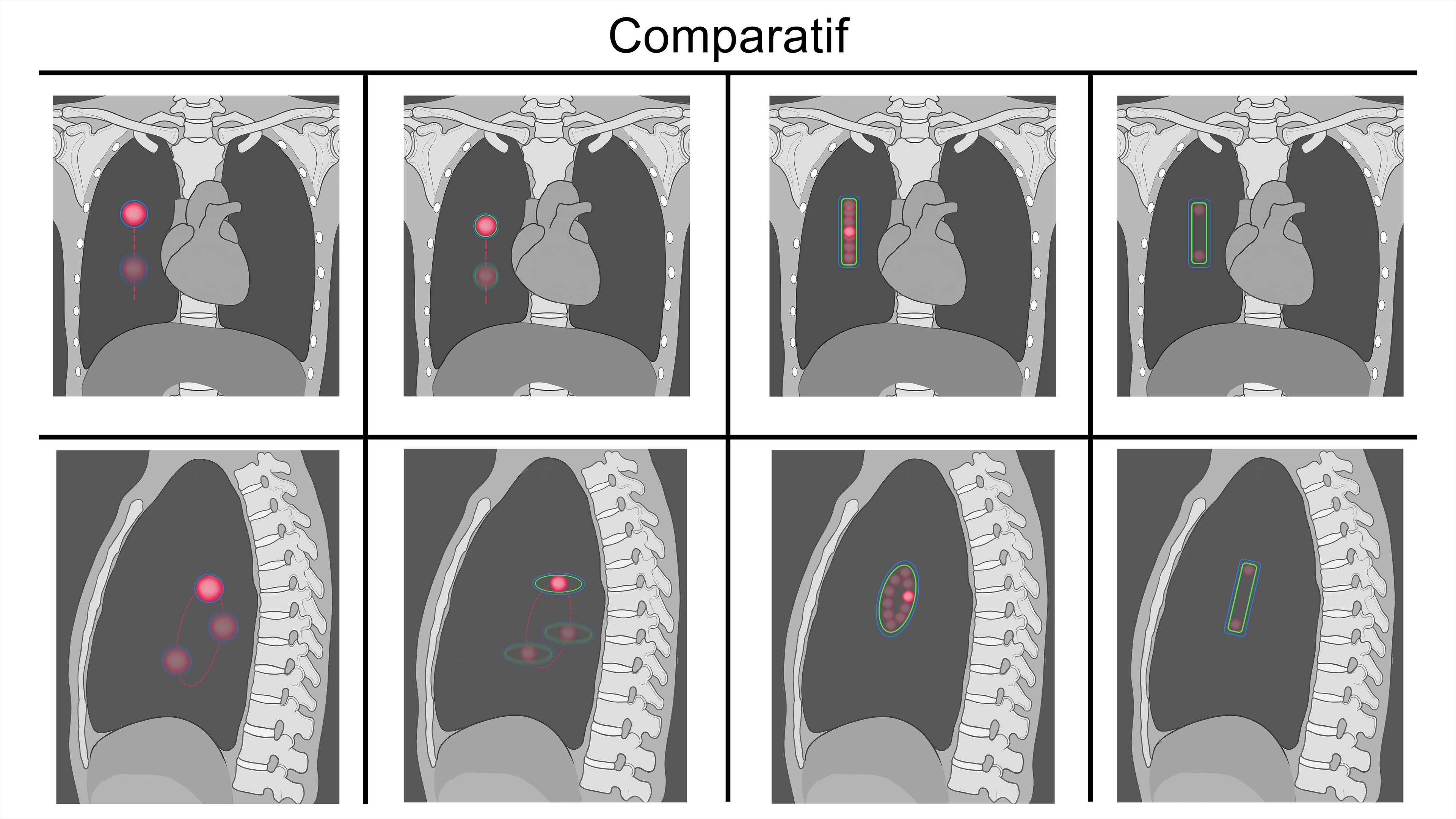 Thèse Comparatif Cyberknife par LucasG